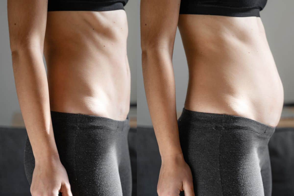 How long does diastasis recti take to improve Dunchurch?
