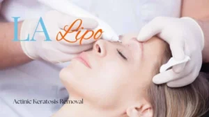 Woman receiving Actinic Keratosis Removal Treatment Dunchurch
