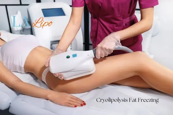 Woman receiving coolsculpting Dunchurch treatment on her thighs