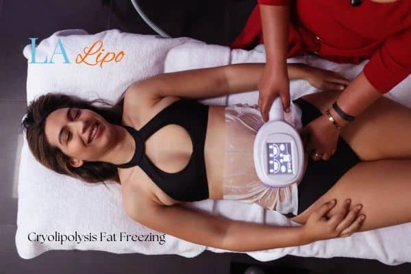 woman getting cryolipolysis Dunchurch