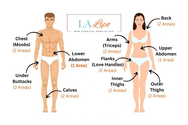 LA LIPO Cryolipolysis Areas Dunchurch
