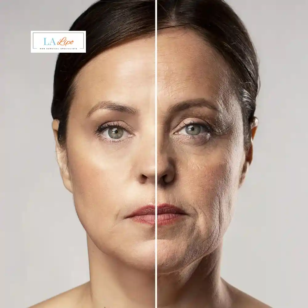 How Can You Tell If Non-Surgical Skin Tightening Is Right for You Dunchurch?