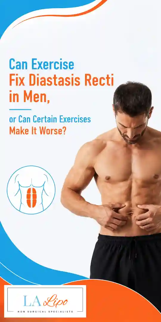 Can Exercise Fix Diastasis Recti in Men, or Can Certain Exercises Make It Worse Dunchurch?